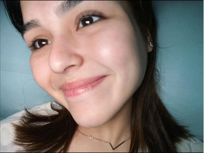 Saat kecelakaan terjadi, Laura sendiri tengah berada di kursi penumpang mobil yang dikendarai oleh Gaga Muhammad. Mobil tersebut kemudian mengalami kecelakaan hingga menyebabkan kelumpuhan bagi Laura. Sementara itu Gaga hanya mengalami beberapa luka ringan. Foto: Instagram/@edlnlaura