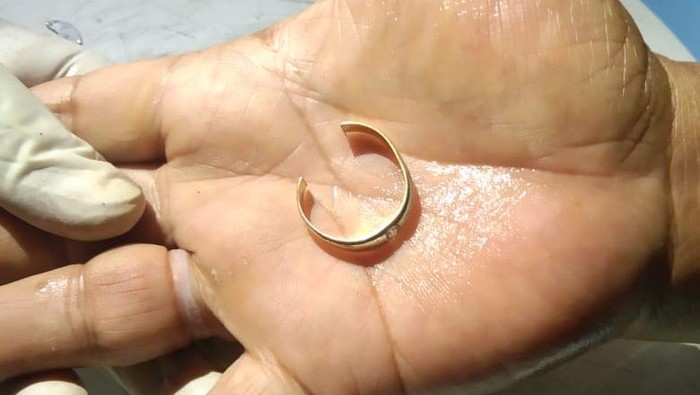 Aksi petugas damkar bantu warga mencpot cincin yang sudah terpasang hampir setahun