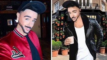 Dagunya panjang sekali dan tidak proporsional. Foto: Boredpanda