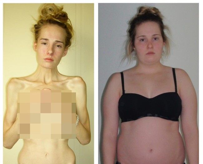 Aku bergabung di grup yang lebih populer di sekolah tapi aku ditindas. Aku punya teman tapi aku selalu jadi target. Dan sebagai seseorang yang perfectionist aku bagus dalam banyak hal tapi tidak pernah jadi yang terbaik dan itu menggangguku, Foto: Instagram Gemma Walker