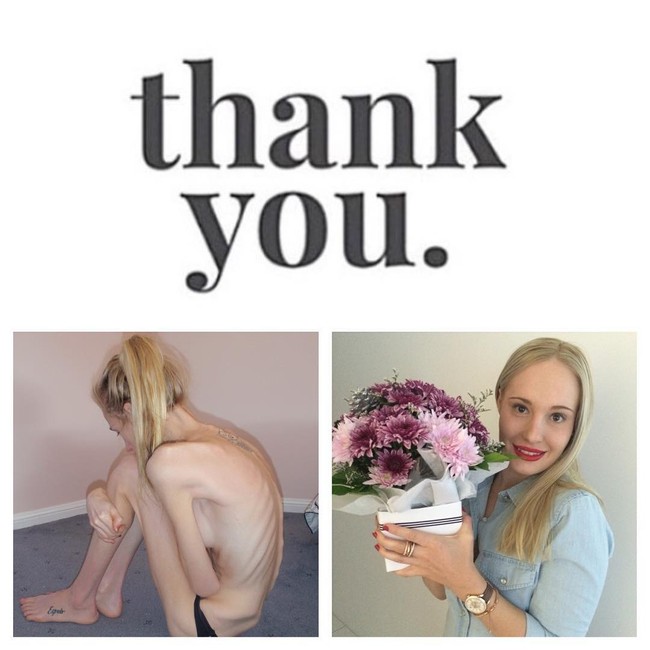 Begini penampilannya saat masih menderita anoreksia nervosa dan ketika memutuskan untuk menyembuhkan gangguan makannya. Foto: Instagram @gemswalker