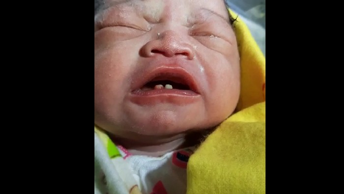 Screenshot video viral bayi lahir dengan 2 gigi (Foto: Istimewa)