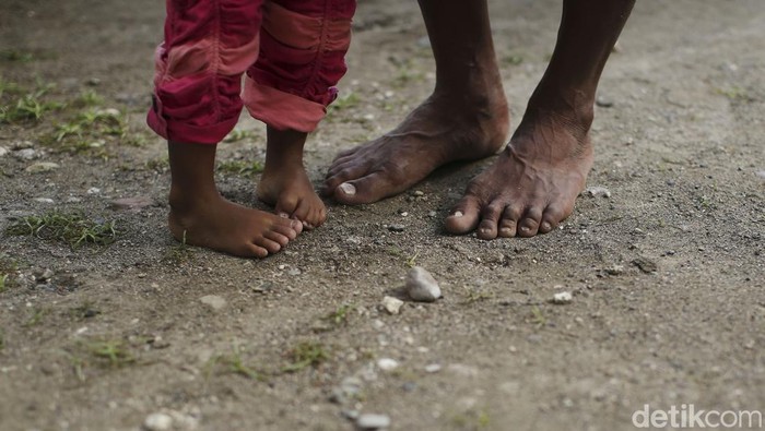 Ditengah percepatan pembangunan infrastruktur, Indonesia justru masih bergelut dengan stunting. Angka terbesar stunting berada di Nusa Tenggara Timur, begini potretnya.