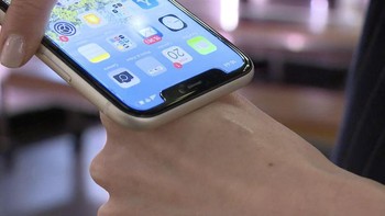 Nantinya pengguna microchip ini dapat membawa paspor COVID-19 di lengan mereka.  