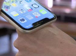 Microchip Bukti Vaksin COVID-19 Ditanam ke Tangan Manusia