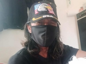 Doni Cerita Detik-detik Dipatuk Kobra: Nyaris Pingsan, Hidup-Mati 50:50