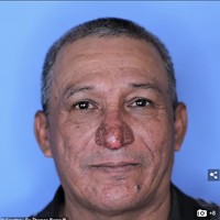 Keberuntungan datang pada Conrado Estrada saat dia mengecat rumah Dr. Thomas Romo di Bronxville, New York. Menyadari kondisi hidung Conrado, sang dokter menawarkan diri untuk melakukan pemeriksaan. Dan sebagai hadiah Natal, dia bersedia memperbaiki hidung Conrado Estrada. Kini Conrado bisa tersenyum tanpa malu setelah menjalani operasi rekonstruksi hidung. Foto: Dok. Dr. Thomas Romo