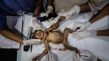 Top 10, karya Alain Schroeder, Belgia. Menampilkan seluruh tim di Pusat Karantina SOCP, Sibolangit, Sumatera Utara, Indonesia yang mempersiapkan operasi Brenda, orangutan betina yang diperkirakan berusia 3 bulan (belum memiliki gigi). Foto: Viewsonic ColorPro Awards