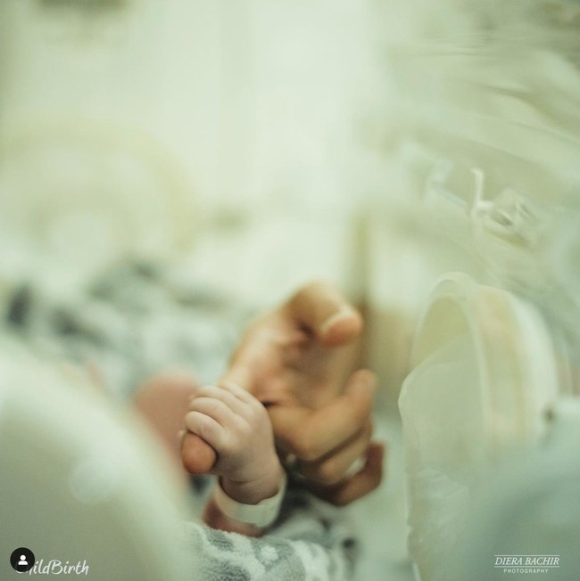 Melalui foto unggahan terbarunya di Instagram Rizky Billar menjelaskan bahwa proses persalinan sang istri berlangsung dengan cara caesar. Walaupun lahir sebelum waktunya, namun bayi Lesti dan Billar berhasil keluar dalam kondisi yang sehat dan memiliki anggota tubuh yang lengkap. Foto: Instagram/@rizkybillar