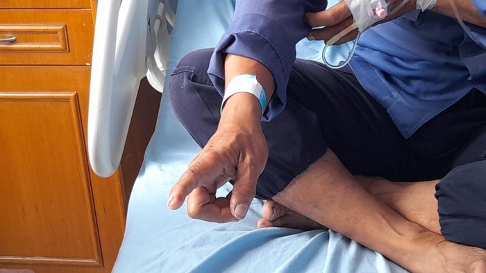 Dua anggota Damkar Kota Bogor dipatuk ular kobra
