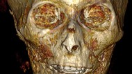 Pertama Kali, Mumi Firaun Usia 3.000 Tahun Diteliti Pakai CT Scan