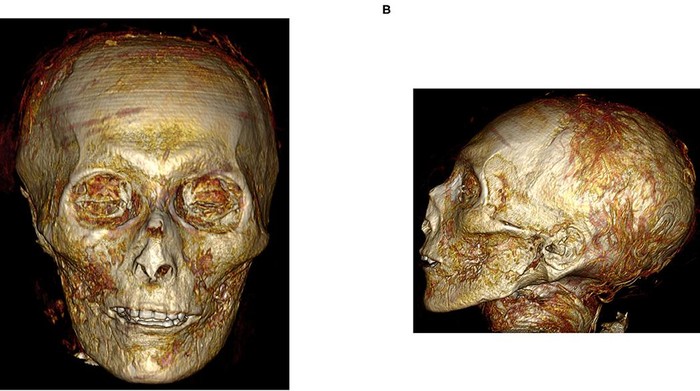 hasil ct scan mumi firaun