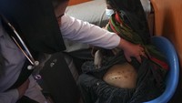 Seorang perawat menunjukkan bekas luka Chinar, yang menjalani operasi pengangkatan ginjal, di sebuah pemukiman dekat Herat, Afghanistan. Chinar mengatakan suaminya sakit dan dia harus menjual ginjalnya untuk memberi makan keempat anaknya. Orang miskin Afghanistan semakin terpuruk dan putus asa.