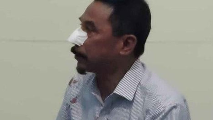 Mantan Bupati Bolaang Mongondow Timur (Boltim), Sehan Salim Landjar menjadi korban penganiayaan. Polisi menyebut pelaku telah diamankan. (dok Istimewa)