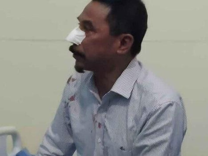 Mantan Bupati Bolaang Mongondow Timur (Boltim), Sehan Salim Landjar menjadi korban penganiayaan. Polisi menyebut pelaku telah diamankan. (dok Istimewa)