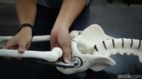 Implan atau total hip arthroplasty ini dikembangkan oleh Ika Kartika, Muhammad Satrio Utomo, Galih Senopati, Yudi Nugraha Thaha, Aprilia Erryani, dan Rahyussalim. 
