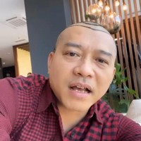 Sebelum dilakukan proses transplantasi rambut, kepala Anang Hermansyah terlihat digambar terlebih dahulu untuk menandai bagian mana yang akan dilakukan prosedur transplantasi tersebut. Foto: Instagram/@ananghijau