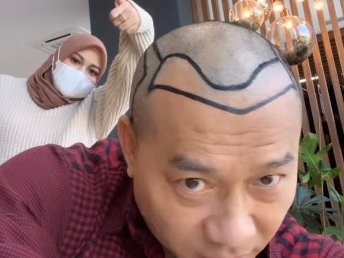 Anang Hermansyah Anang Hermansyah