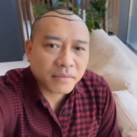 Beberapa waktu lalu Anang Hermansyah baru saja terlihat memamerkan penampilan barunya dengan rambut botak. Bukan tanpa alasan, rambutnya itu sengaja potong habis karena dirinya ingin melakukan transplantasi rambut. Foto: Instagram/@ananghijau