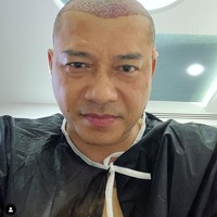 Anang Hermansyah pun tampak mengunggah foto saat dirinya sudah selesai menjalani proses transplantasi rambut. Foto inilah yang kemudian dibanjiri komentar netizen yang menyamakannya dengan Raul Lemos. Foto: Instagram/@ananghijau