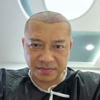 Anang Hermansyah menjalani transplantasi rambut di Turki. Ayah empat anak ini ingin rambutnya lebih lebat di usia yang sudah menginjak kepala lima. Foto: Instagram/ananghijau