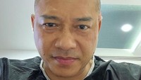 Tak hanya berlibur ternyata Anang Hermansyah juga melakukan transplantasi rambut di sebuah klinik di Istanbul, Turki. Pamerkan penampilannya yang berubah, rambut baru Anang Hermansyah jadi sorotan netizen. Foto: Instagram/ananghijau