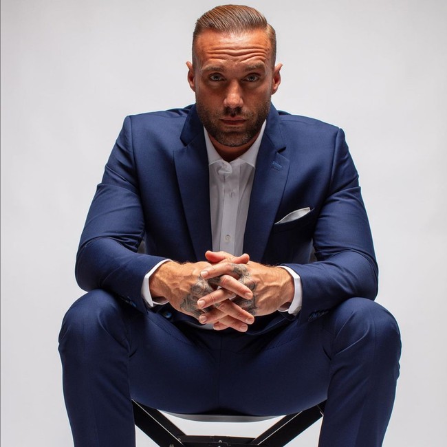 Model Calum Best melakukan transplantasi rambut pada 2015 dengan lebih dari 6.000 helai ditanamkan di kulit kepala bagian depan. Tiga kali menjalani cangkok rambut diakuinya telah mengubah hidup dan kariernya jadi lebih baik. Foto: Instagram