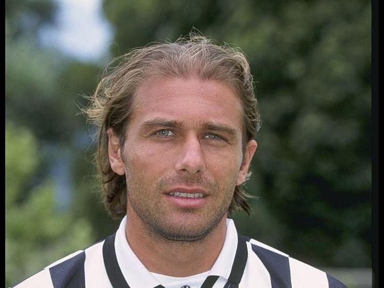 Conte Botak Dini, Kini Gondrong Lagi... Transplantasi adalah Kunci!