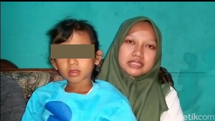 Bocah di Brebes diduga mengidap kelamin ganda