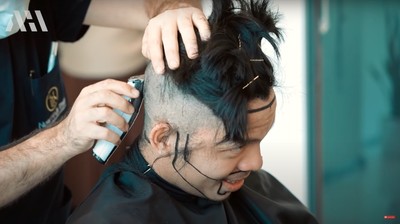 7 Momen Atta Halilintar Transplantasi Rambut, Terpaksa Jadi Botak