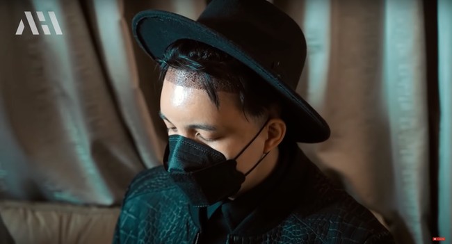 Setelah melakukan transplantasi rambut, Atta Halilintar tidak diperbolehkan untuk keramas selama 10 hari. Tak hanya itu saja, nantinya Atta juga harus menggunakan shampoo khusus untuk rambutnya. Foto: YouTube/AH