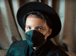 Foto Before After 7 Artis Indonesia Transplantasi Rambut, Ada Atta Halilintar