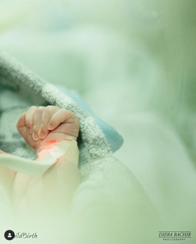 Melalui salah satu unggahan Instagram milik Rizky Billar diketahui bahwa Lesti melahirkan anak pertamanya secara prematur saat kehamilannya masih berusia 34 minggu. Walaupun prematur, namun anak pertama Lesti dan Billar itu terlahir secara sehat tanpa kekurangan apapun. Foto: Instagram/@rizkybillar