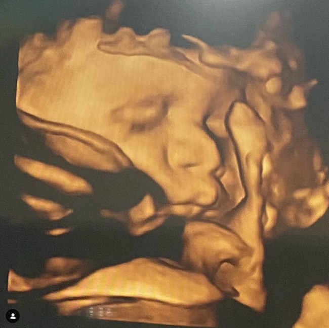 Lesti Kejora melahirkan anak pertamanya pada 26 Desember 2021. Sebelum melahirkan, Rizky Billar sempat terlihat membagikan hasil foto USG sang jabang bayi melalui akun Instagramnya. Foto: Instagram/@rizkybillar