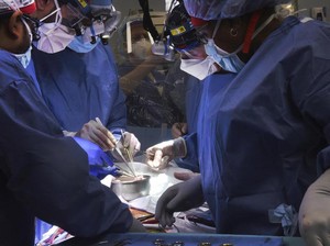 Ilmuwan Teliti Pemicu Gagalnya Cangkok Jantung Babi ke Manusia, Ini Hasilnya