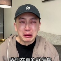 Saat itu, dokternya berbohong padaku dan berkata bahwa itu hanya sebuah suntikan tapi fat grafting sebenarnya adalah operasi besar dan bisa membunuhmu kalau tidak dilakukan dengan benar, ungkap Abel.  Foto: Douyin/Weibo Jin Dawei