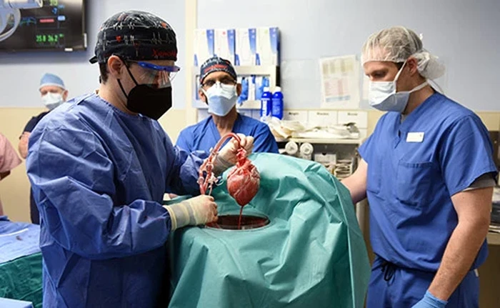 transplantasi jantung babi transplantasi jantung babi