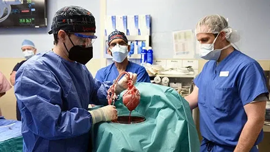 Pertama Kali di Dunia! Transplantasi Jantung Babi ke Manusia