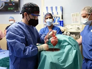 Pertama Kali di Dunia! Transplantasi Jantung Babi ke Manusia