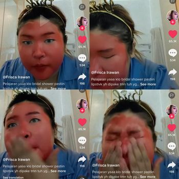 Wanita ini viral karena wajahya merah dan tidak bisa hilang usai acara bridal shower.