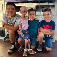 Remaja asal Texas, AS itu memiliki tubuh yang kecil, dan memiliki kulit keriput. Adalia pun tak memiliki rambut. Tinggi tubuhnya bahkan lebih mungil dibanding ketiga adiknya. Foto: dok. Instagram/@adalia06