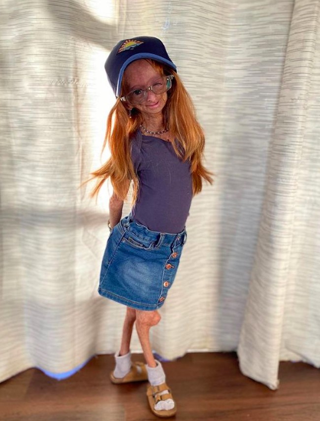 Adalia pun kerap memposting foto di Instagram. Inilah gaya imut dan kece Adalia mengenakan rok dan topi. Foto: dok. Instagram/@adalia06