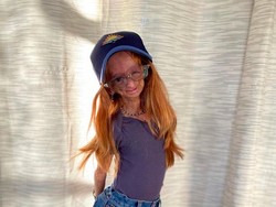 10 Foto Adalia Rose, Youtuber yang Meninggal karena Sindrom Benjamin Button