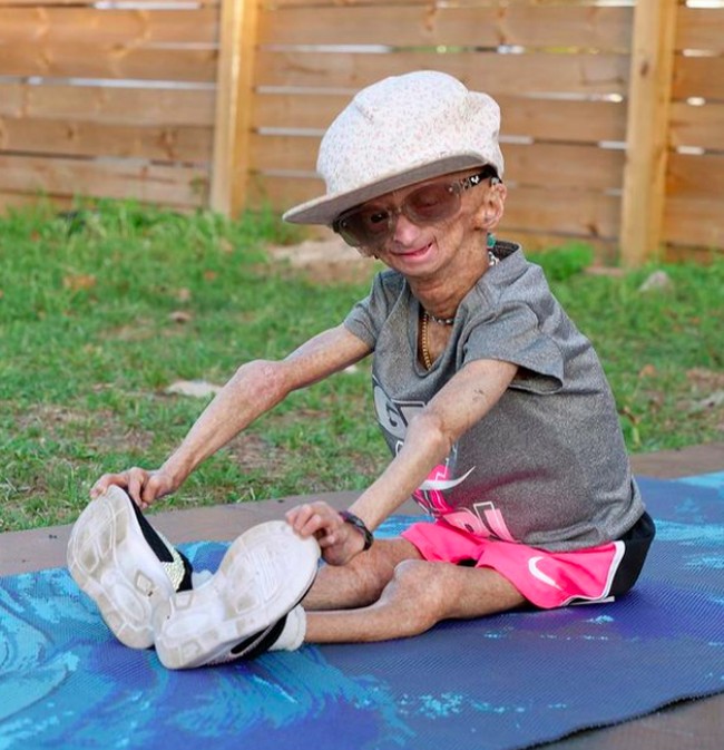 Ia bahkan rajin berolahraga. Meski olahraga ringan seperti peregangan, namun Adalia tampak begitu bersemangat menjalani hidupnya. Foto: dok. Instagram/@adalia06