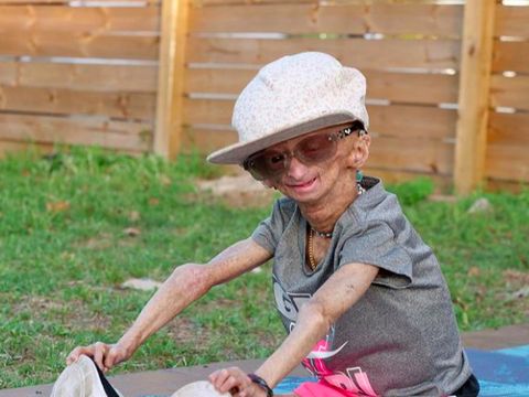 Adalia Rose