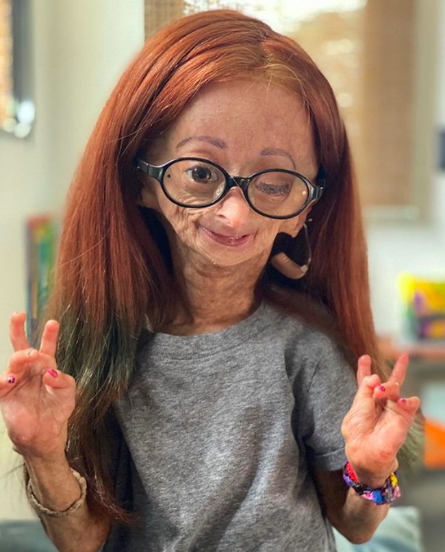 Di kesehariannya, Adalia sering menggunakan wig. Dia pun mengaku ingin menjadi gadis-gadis seperti pada umumnya. Foto: dok. Instagram/@adalia06