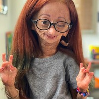 Di kesehariannya, Adalia sering menggunakan wig. Dia pun mengaku ingin menjadi gadis-gadis seperti pada umumnya. Foto: dok. Instagram/@adalia06