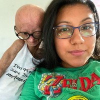 Ibu Adalia, Natalia Pallente pernah menceritakan 2018. Di awal bulan setelah kelahirannya, dokter menyadari ada sesuatu yang salah dengan kondisi kesehatannya. Pada tiga bulan, Adalia mendapatkan diagnosisnya, dan setelah itu mulai mengalami kerontokan rambut. Pembuluh darahnya juga menjadi terlihat, dan kulitnya menipis.Foto: dok. Instagram/@adalia06