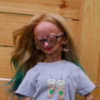 Begitu juga dengan Adalia. Sindrom tersebut menyebabkan penuaan yang cepat terjadi. Padahal ketika lahir, Adalia tampak normal. Foto: dok. Instagram/@adalia06