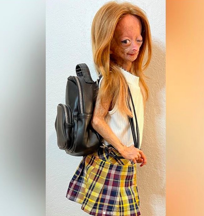 Beginilah penampakan Adalia menjelang ajalnya. Foto ini diunggahnya di Instagram pada 29 Desember. Foto: dok. Instagram/@adalia06